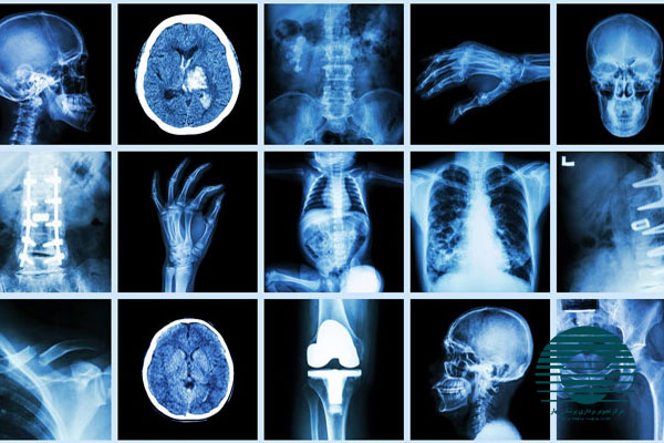 رادیولوژی چیست و چه کاربردی دارد؟