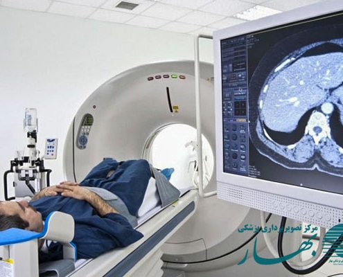 رایجترین سئولات درباره سی تی اسکن