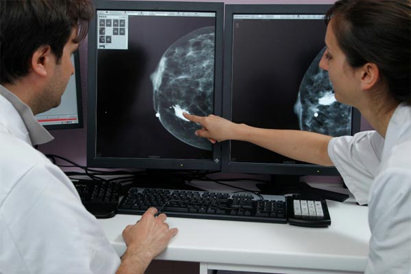 تشخیص بیماری سرطان سینه