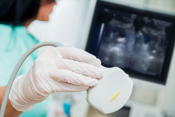 تشخیص کیست تخمدان با سونوگرافی