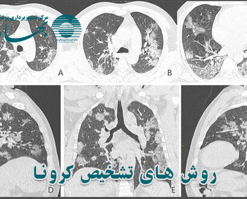 بهترین روش تشخیص ویروس کرونا