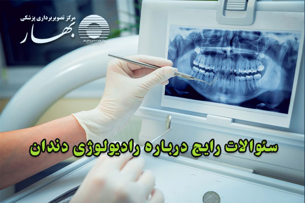 پاسخ به رایج ترین سوالات درباره رادیولوژی دندان