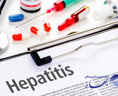 راه های انتقال و علائم هپاتیت C در زنان