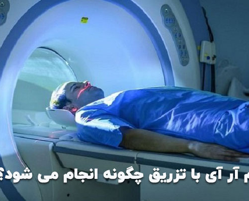 ام آر آی با تزریق چگونه انجام می شود؟
