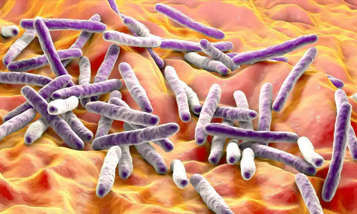 مایکوباکتریوم توبرکلوزیس (Mycobacterium tuberculosis)