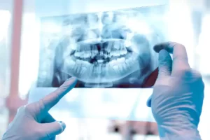 رادیولوژی دندان در کرج