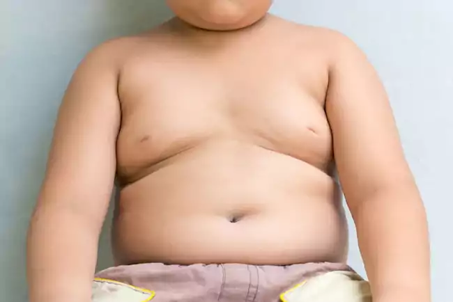 علل چاقی در کودکان