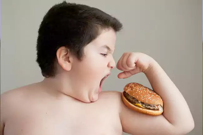  چاقی در کودکان